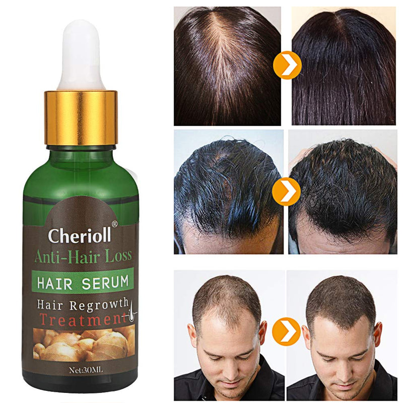 [Australia] - Hair Growth Serum, Hair Loss and Hair Thinning Treatment, Stops Hair Loss, Thinning, Balding, Repairs Hair Follicles, Promotes Thicker, Stronger Hair and New Hair Growth 