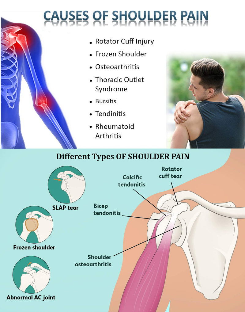 [Australia] - Wonder Care-Left Right Shoulder Immobilizer Arm Sling Elastic Brace for Clavicle Collar Bone Dislocation Subluxation Shoulder stabilizer Compression Brace After Rotator Cuff Surgery - Black-Size 2 Size-2(31"-35") 