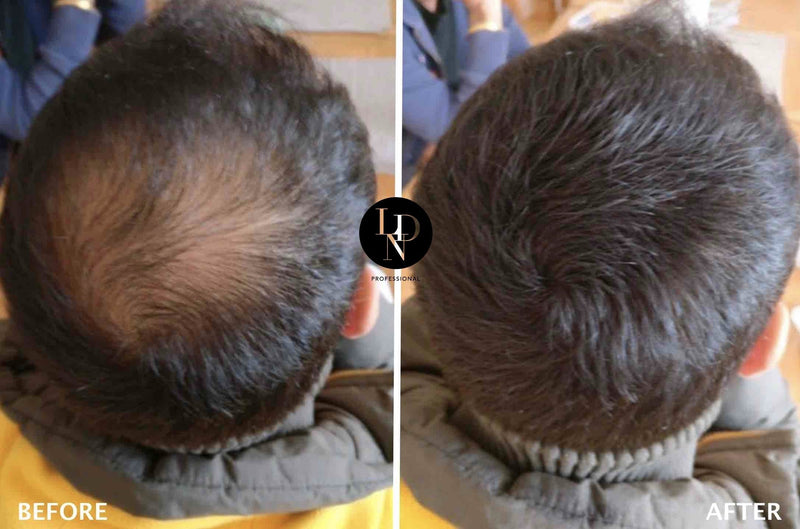 [Australia] - LDN Professional Hair Building Fibres - No1. Hair Fibres for Hair Loss and Thin Hair, Instantly Thicken Hair Naturally, 22g hair fiber bottle (Black) Black 