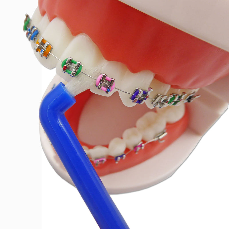 [Australia] - 6 x Slim Interspace Toothbrush, Blue Brushes for Orthodontic Braces & Bridges 