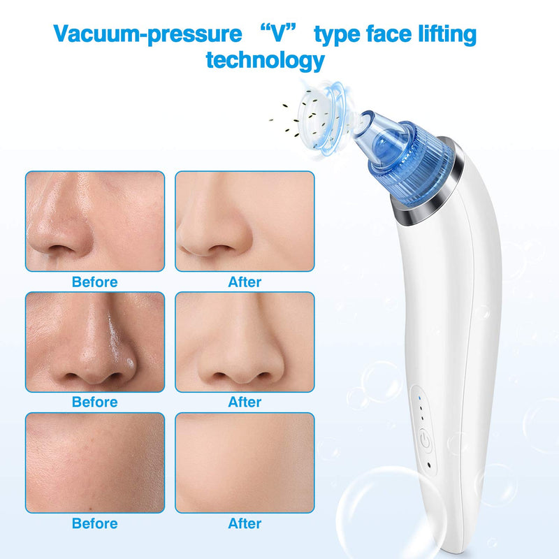 [Australia] - Blackhead Remover Electric Pore Vacuum Blackhead Remover for Men Women Comedone Acne Extractor Suction Tool Facial Cleanser with Kit, USB Rechargeable, 4 Probes, Adjustable Modes Blue 