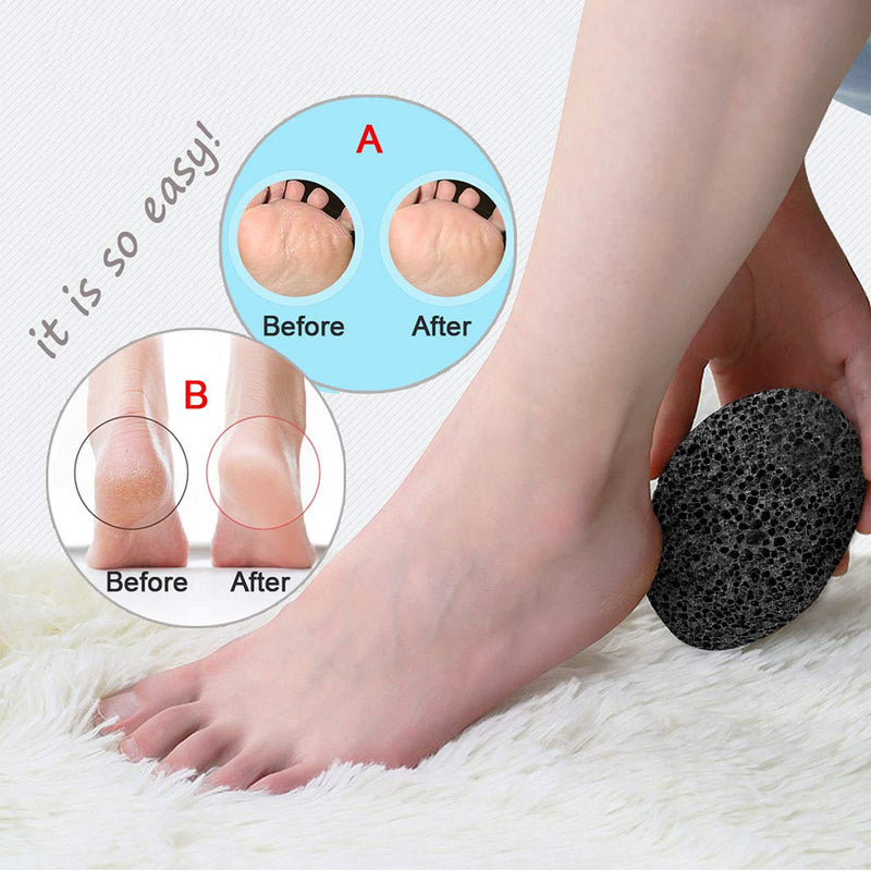 [Australia] - Symlis Natural Pumice Stone for Feet - Lava Callus Remover Feet - Health Foot Care - Pedicure Exfoliation Tool - Great for Corn Dead Skin Remover For Feet and Hands (2 Packs) 