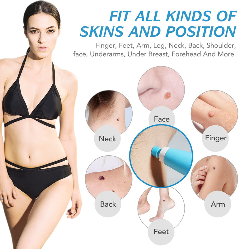 [Australia] - Skin Tag Removal, Skin Tag Remover Kits to Remove Skin Tags Painless and Safe, Skin Tag Removal Device for Large and Micro (2-8mm) for All Body Parts, Easy to Use 