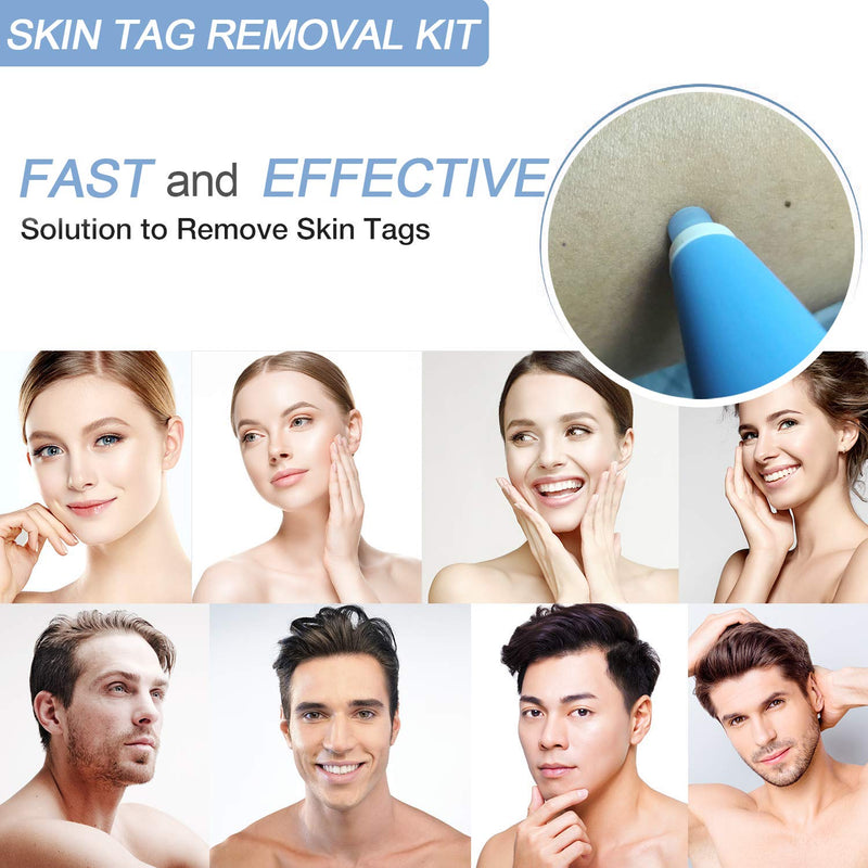 [Australia] - Lescolton Auto Skin Tag Remover Kit Skin Tag Removal Device 40X Bands Wart Removal Skin Tag Remover (B30) B30 