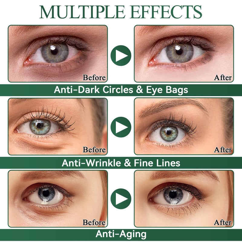 [Australia] - Eveellyn Under Eye Patches, Natural Aloe Vera Hydrogel Under Eye Pads Masks for Hydrating and Anti-aging Treatment for Puffy Eyes, Fine Lines and Wrinkles, Eye Bags, Dark Circles 60Pcs/30Pairs 