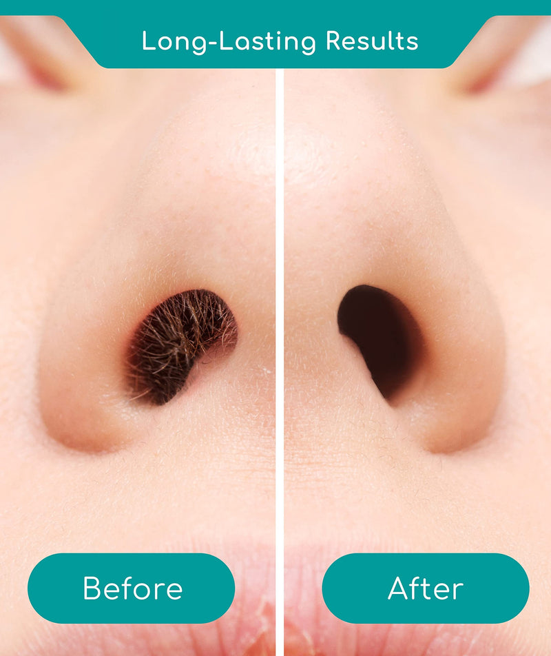 [Australia] - Medi Grade Nose Waxing Kit for Men & Women With 50x Nose Wax Sticks. 100g Nose Hair Wax Kit Including Skin Tape, Tweezers, Towel, Microwavable Cup & Storage Bag - Easy & Safe Nose wax kit 