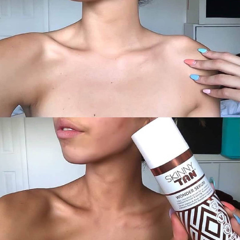 [Australia] - Skinny Tan Wonder Serum Anti-Ageing Tanning Serum 145ml |Tanning Serum with Youth Boosting Q10 and Vitamin E | Cruelty Free & Vegan Skincare for Radiant Natural Glow 