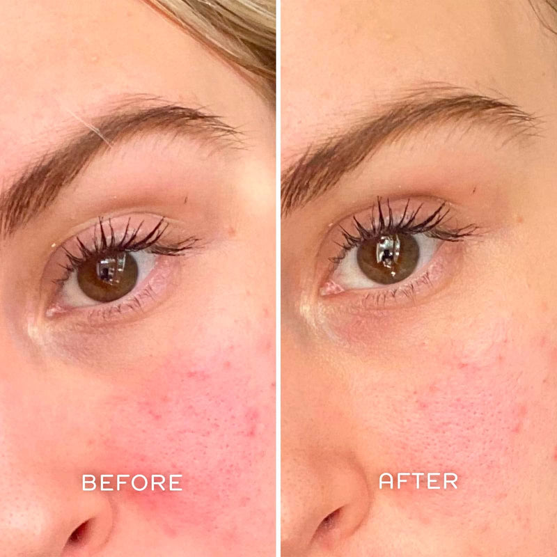 [Australia] - REN Clean Skincare Evercalm Redness Relief Serum 30 ml 