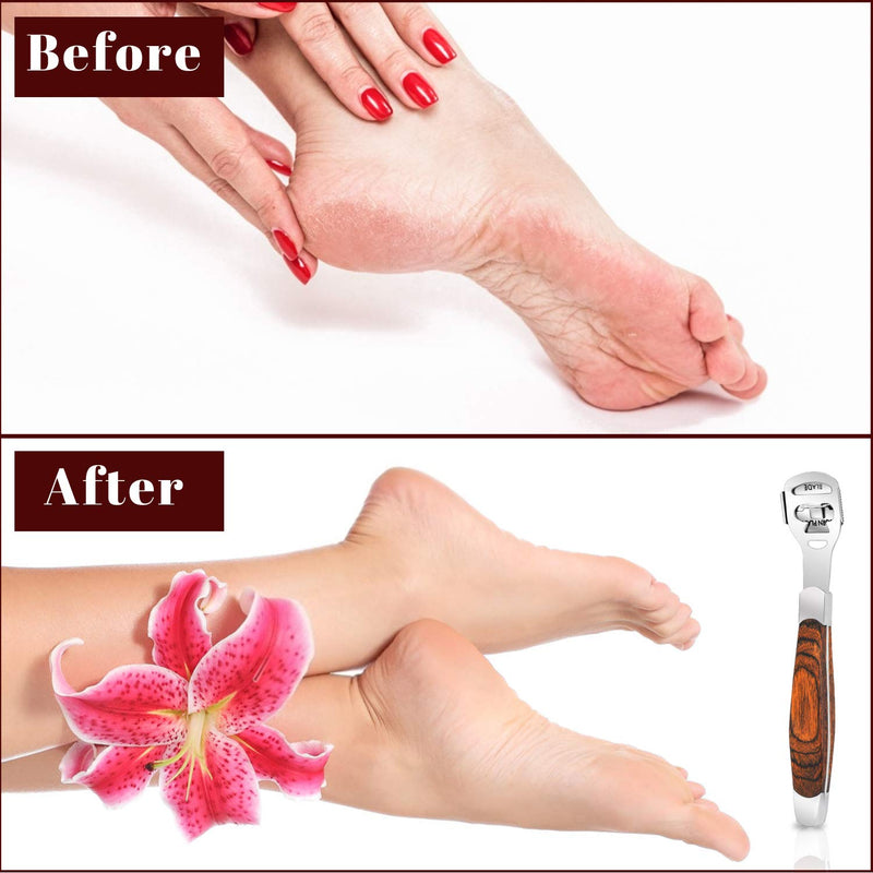 [Australia] - Callus Shaver, Foot Shaver Callus Remover for Feet Hand Care with Foot File, 10pcs Blades, Foot File Head and Dead Skin Storage Cover (15Pcs in Total) 