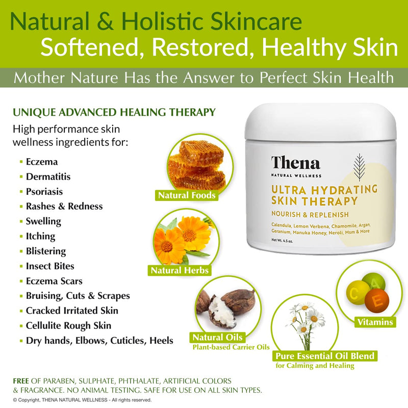 [Australia] - Ultra Hydrating Skin Cream For Eczema Treatment Scalp Psoriasis Dry Itchy Skin Rosacea Rashes Seborrheic Dermatitis Natural Organic Moisturizing Ointment Lotion (4.5 ounce) 4.5 Ounce 