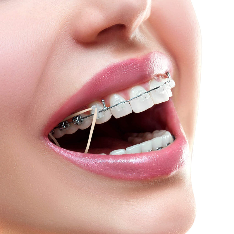 [Australia] - Annhua 500Pcs Orthodontic Elastics Rubber Bands, 5 Pcs Placers Included, Fox 1/4'' 4.5OZ Dental Braces Rings for Teeth Gap, Braces, Crooked Teeth,etc Fox 4.5oz 1/4" 