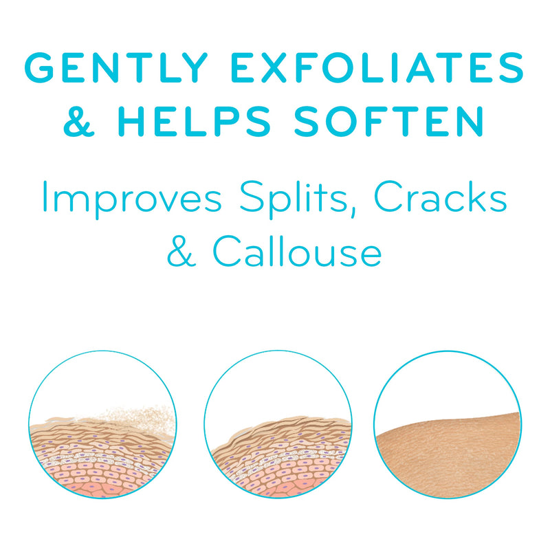 [Australia] - AmLactin Foot Repair Foot Cream Therapy, Foot Cream for Dry Cracked Heels - 3 Oz Tube (Packaging may vary) Unscented  3 Ounce (Pack of 1) 