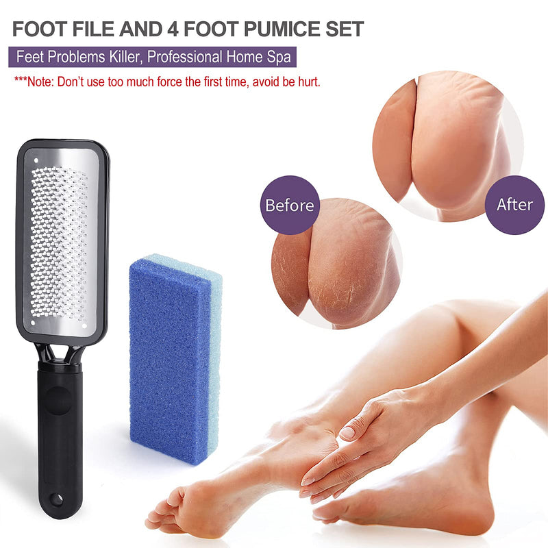 [Australia] - Professional Foot File Set, One Portable Foot File and 4 Packs of 2 in 1 Foot Pumices, Vimiv Rust-Resistant Foot Scrubber, Durable Foot Pedicure Kit for Rough,Dead Skin Removal, Callus, Wet & Dry Feet 