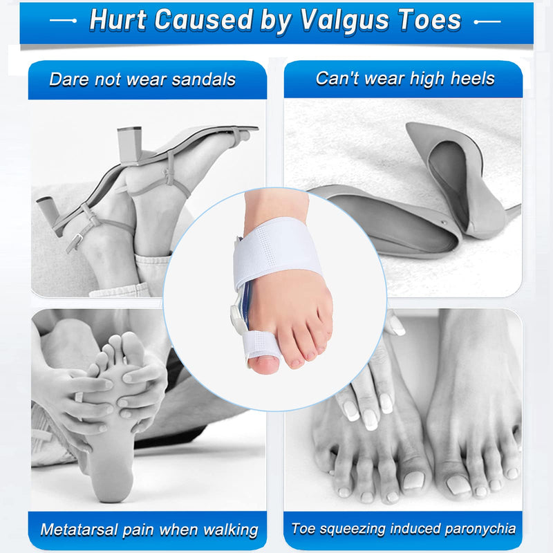 [Australia] - Paskyee Bunion Corrector, Orthopedic Bunion Toe Straightener for Women and Men 2 PCS, Adjustable Bunion Splint with Toe Separator for Bunion Relief White 