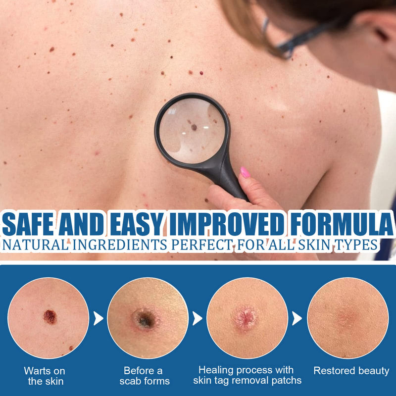 [Australia] - Skin Tag Removal Patches,Mole Removal Patches,Wart Removal Sticker,Spot Removal Stickers,Fast-Acting for Different Size of Warts,180pcs 