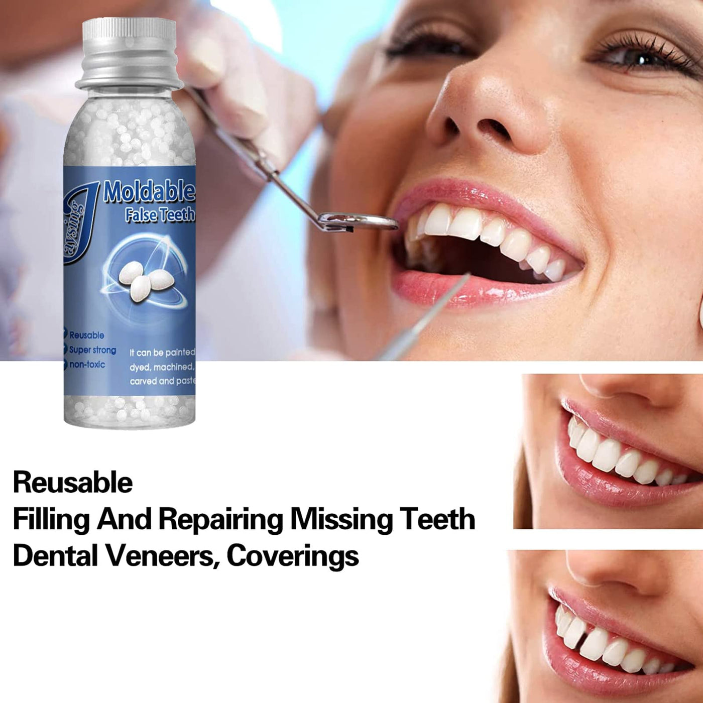Tooth Repair Moldable,Teeth Filling Beads,Tooth Repair Beads,Teeth Filling  Replacement,Temporary Tooth Repair Beads,Dental Tooth Beads,Dental Tooth  Filler,Snap On Instant and Confident Smile,10ML