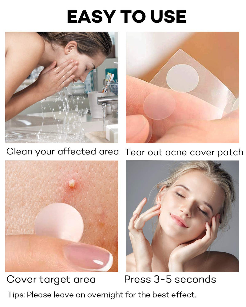 [Australia] - Acne Patch Pimple Patch, 4 Sizes 140 Patches Acne Absorbing Cover Patch, Hydrocolloid Invisible Acne Patches For Face Zit Patch Acne Dots Tea Tree, Calendula Oil - 1 Pack 140 Patches (1 Pack) 