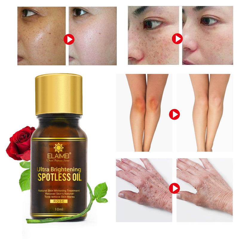 [Australia] - 2 PACK Ultra Brightening Spotless Oil Skin Care Natural Pure Dark Spots Remove Ance Burn Strentch Marks Scar Removal Brightening Skin (10 ml) (spotless oil) 
