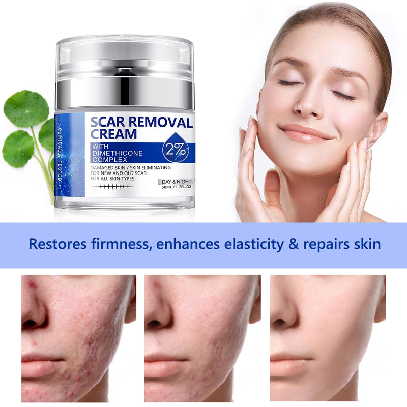 [Australia] - Scar Removal Cream - Rapid Repair of New and Old Scars - Scar Removal and Soothing Cream for Surgical Scars, Acne Scars, C-Section, Burns, Stretch Marks 