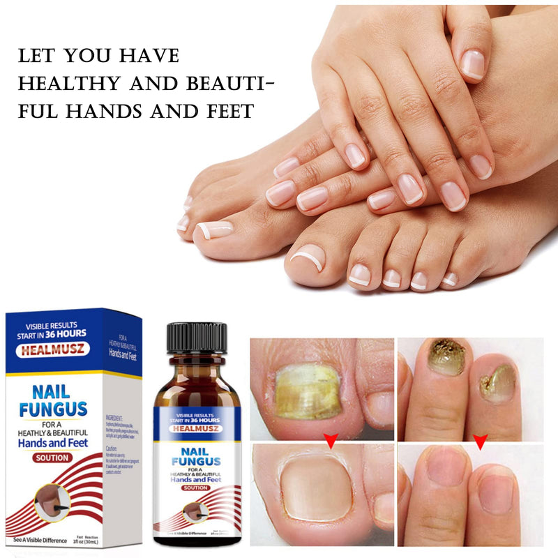 [Australia] - Fungal Nail Treatment,Premium Fungal Nail Eliminator for Toenails and Fingernails Nail Fungus Treatment ,Anti fungal Nail Solution— Fix & Renew Damaged, Broken Nails 