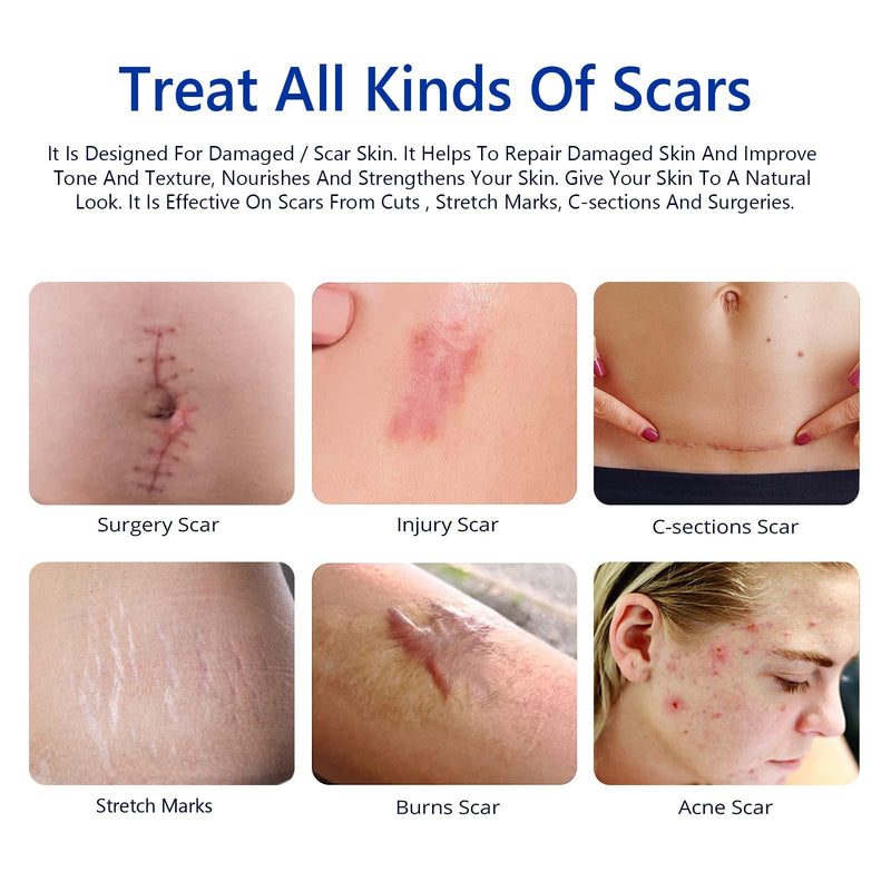 [Australia] - Scar Removal Cream - Rapid Repair of New and Old Scars - Scar Removal and Soothing Cream for Surgical Scars, Acne Scars, C-Section, Burns, Stretch Marks 