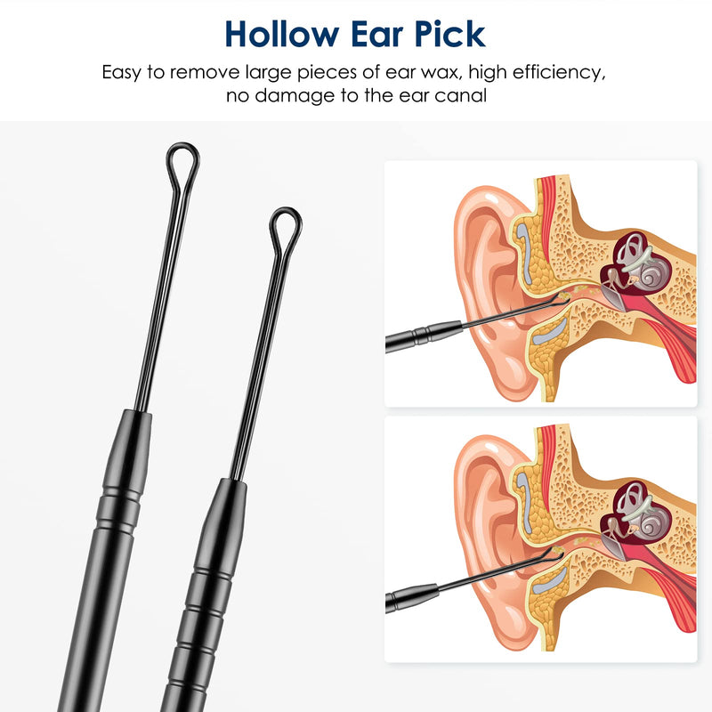 [Australia] - Ear Cleaning Kit,Safe Ear Wax Removal Tool,Earwax Removal Kit,Easy to Use,Painless Ear Pick,with Storage Box and Cleaning Brush (Black) Black 