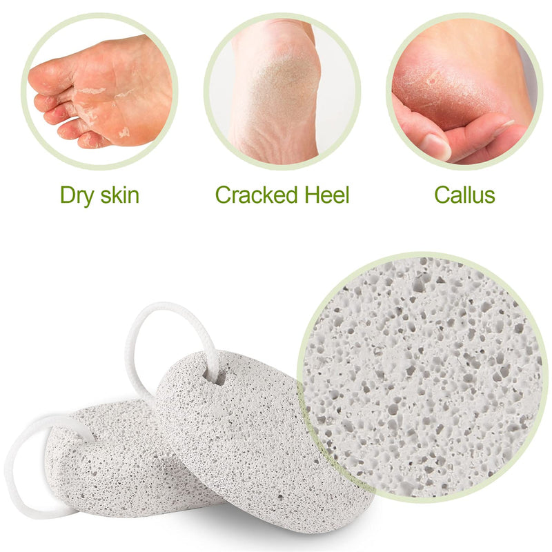 [Australia] - Natural Pumice Stone for Feet 2 PCS,Lava Pedicure Tools Hard Skin Callus Remover for Feet and Hands - Natural Foot File Exfoliation to Remove Dead Skin 