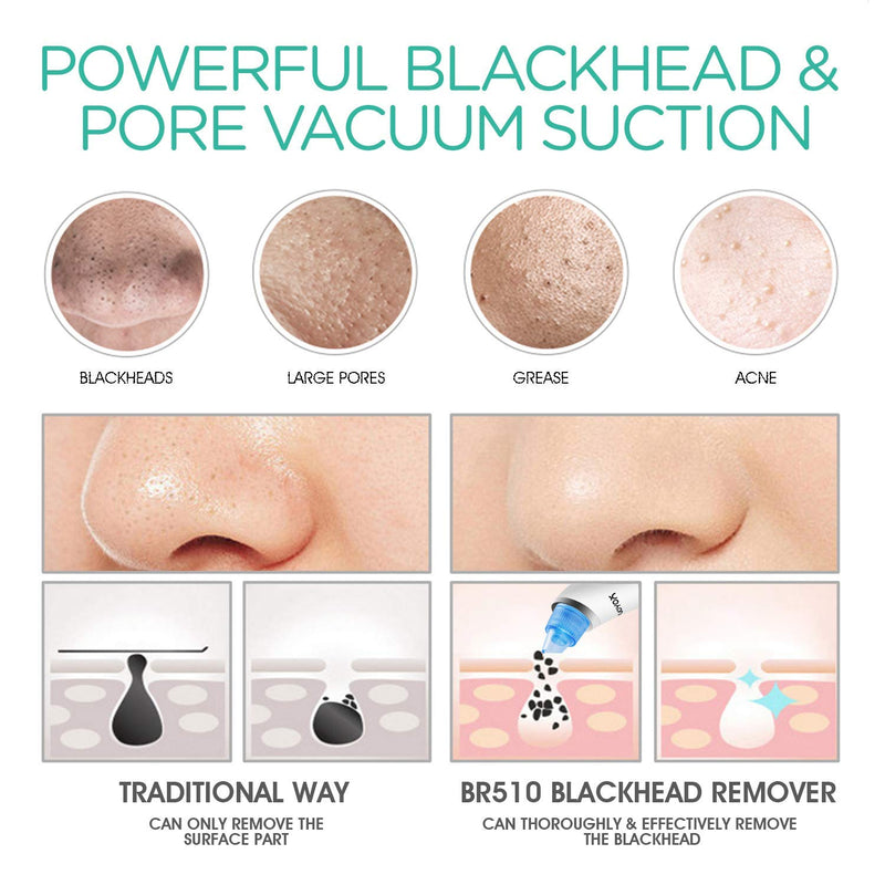 [Australia] - VOYOR Blackhead Remover Pore Vacuum - Electric Face Vacuum Pore Cleaner Acne White Heads Removal with 6 Suction Head and 5 Suction Levels BR510 