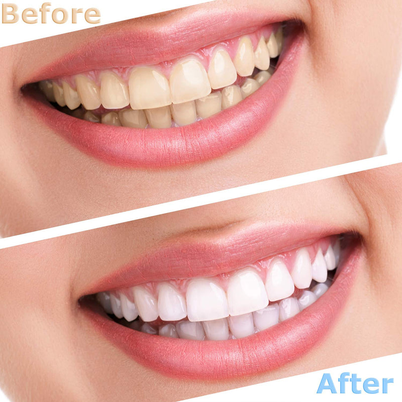 [Australia] - 2 Pairs Dentures Fake Teeth Whitening False Teeth Top and Bottom Temporary Upper and Lower Snap Teeth Cover for Men Women Adult 