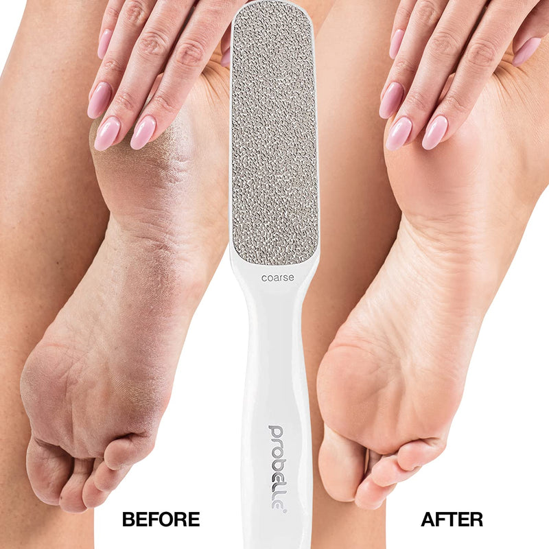 [Australia] - Probelle Double Sided Multidirectional Nickel Foot File Callus Remover - Immediately reduces calluses and corns to powder for instant results, safe tool (White) White 