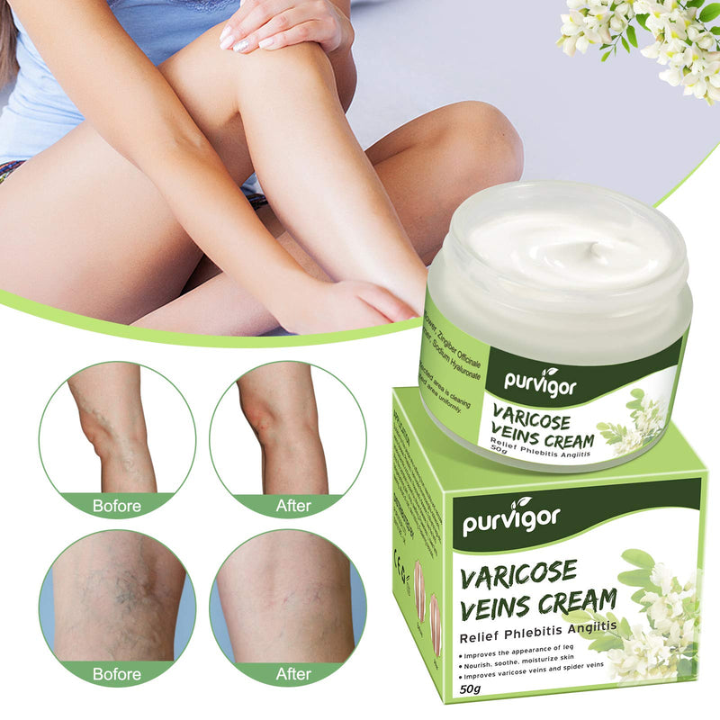 [Australia] - Varicose Veins Cream, Varicose Veins Treatment for Legs, Improves the Appearance of Leg, Repair Spider Veins, Strengthen Capillary Health, Promote Blood Circulation, Relieve Leg Muscle Fatigue, 50g 