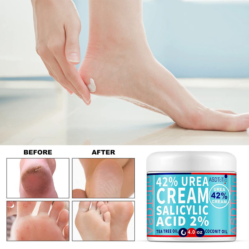 [Australia] - Urea 42% Foot Cream Plus Salicylic Acid 4 Oz - Moisturizes and Rehydrates Feet, Knees & Elbows, Nourishes Softens Dry, Rough Skin 