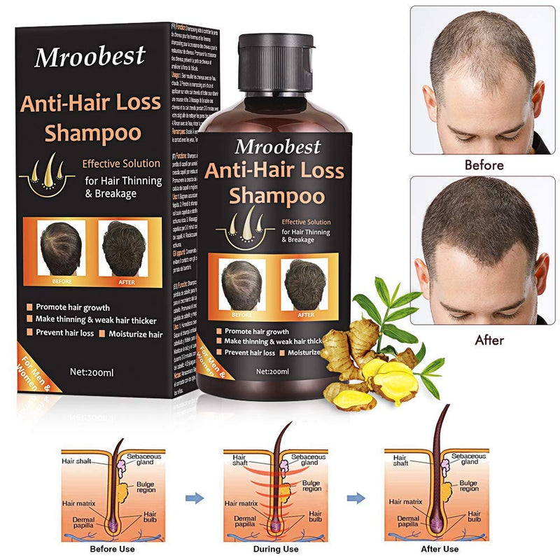 [Australia] - Anti-Hair Loss Shampoo, Hair Growth Shampoo, Effective Solution for Hair Thinning & Breakage, Helps Stop Hair Loss, Grow Hair Fast, Hair Loss Treatment for Men & Women(220mL) 220 ml (Pack of 1) 