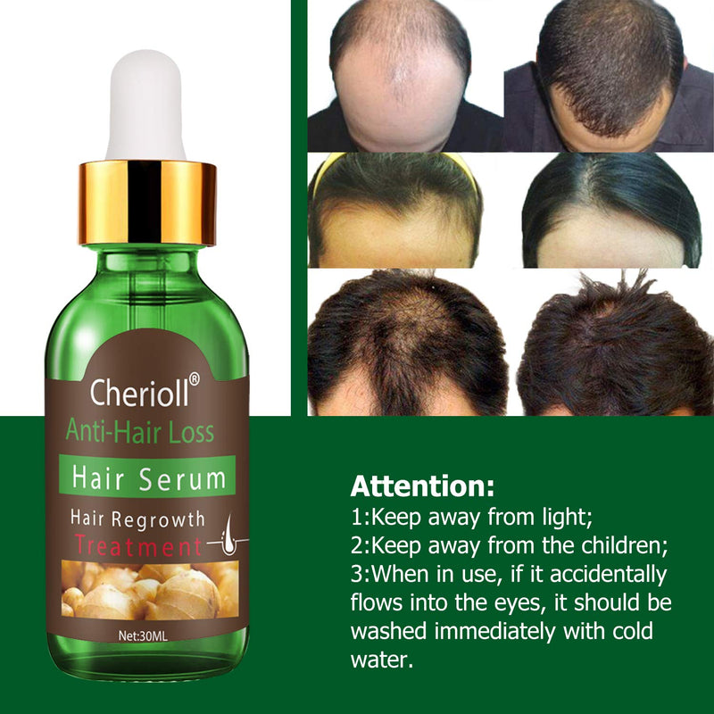 [Australia] - Hair Serum, Hair Treatment Serum Oil, Hair Loss &Hair Thinning Treatment, Hair Growth Oil for Stronger, Thicker, Longer Hair (30ml) 1 Fl Oz (Pack of 1) 