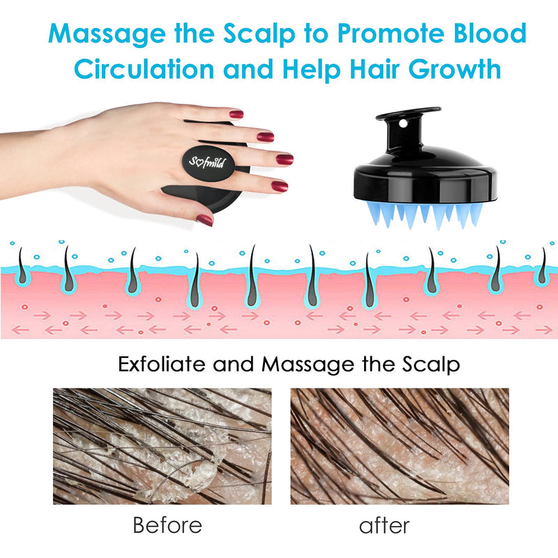 [Australia] - Shampoo Brush, Silicone Scalp Massager Hair Brush Head Massager Hair Growth Scrubber for Straight Curly Long Short Thick Thin Wet Dry Hair for Men Women Kids Pets, Black&Blue Black-blue 