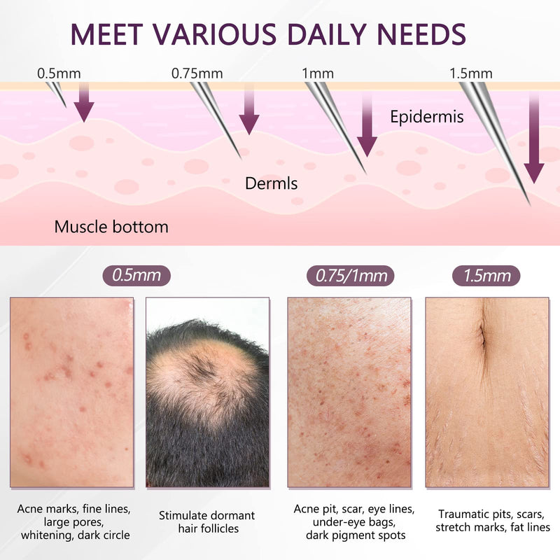 [Australia] - Derma Roller Microneedle Dermaroller Needles: Face Hair Growth Microneedling Micro Needle 0.75mm Needling Regrowth Dermal Scalp Skin Loss Facial Roll Beard Grow Rollers Alcohol Disinfectant Needler Derma Beard Roller 0.75mm 