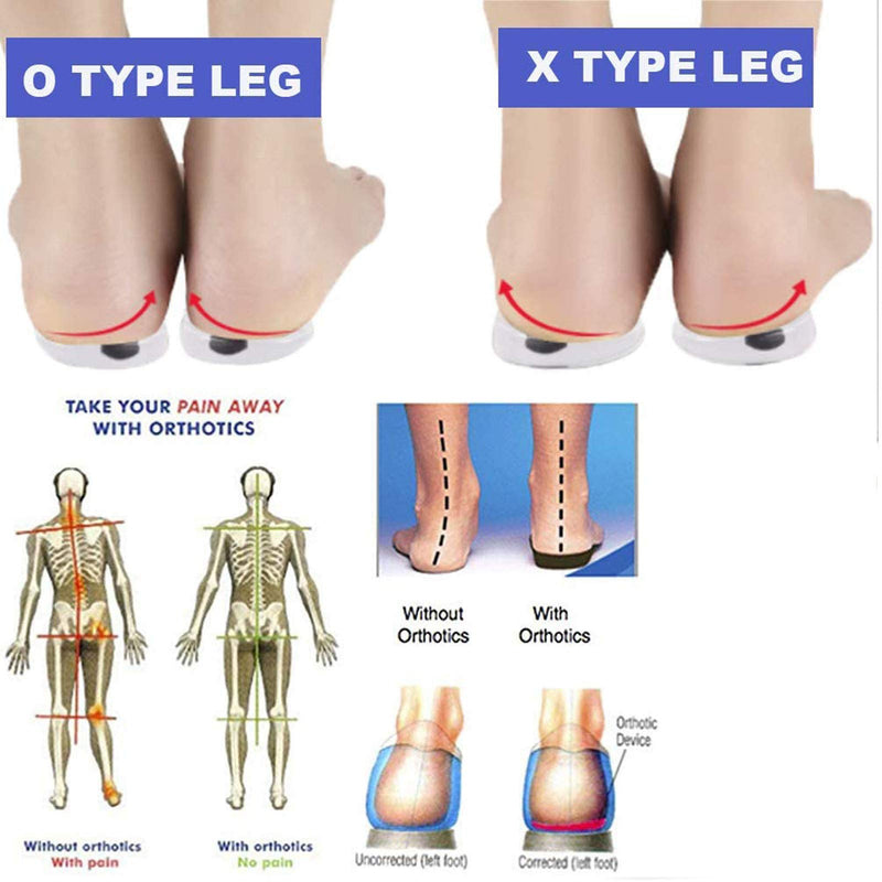 [Australia] - Mcvcoyh 3 Pairs Orthopedic Insoles for Men &Women, Orthotic Inserts, Lateral Heel Wedges Shoe Inserts for Corrective Pronation, Supination, O/X Type Leg Corrective 