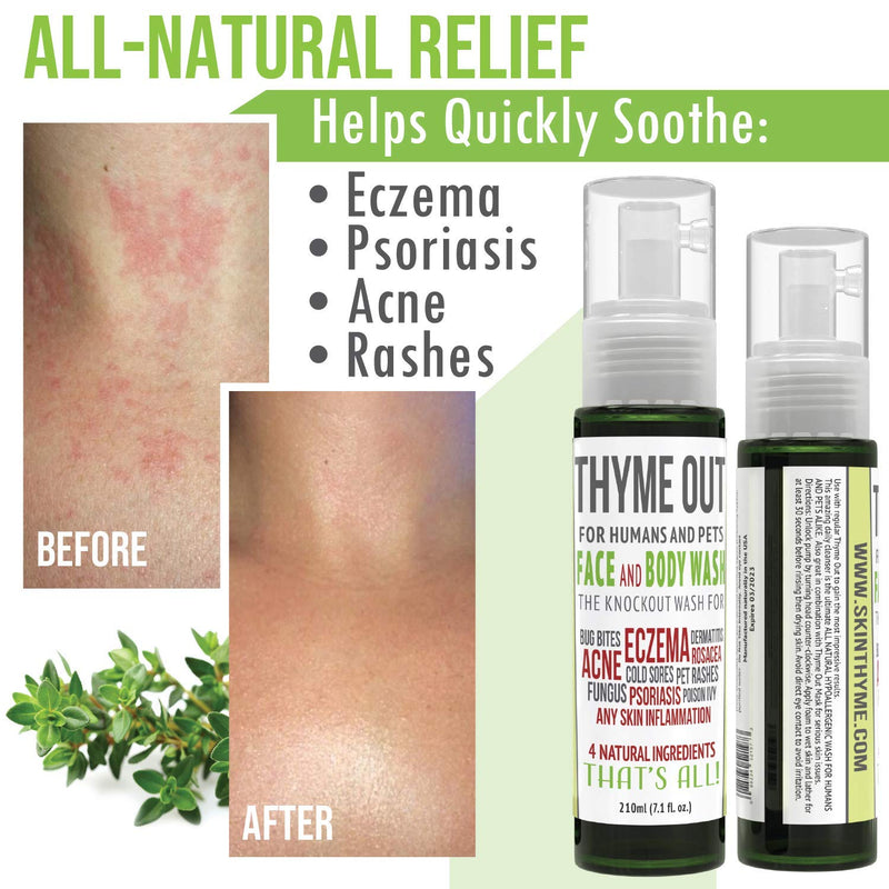 [Australia] - Thyme Out All-Natural Face Wash (210ml) - Organic Body Wash for Acne, Eczema, Poison Ivy and Psoriasis - Soothe Itch, Inflammation and Irritation - Convenient Foam Formula for Easy Application 