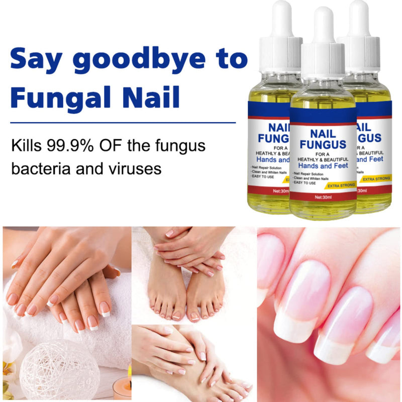 [Australia] - Nail Fungal Treatment, Toenail Treatment Extra Strong Nail Repair Set, Fingernail Toenail Care, Fix Renew Damaged, Broken, Anti Fungus Nail Repair 