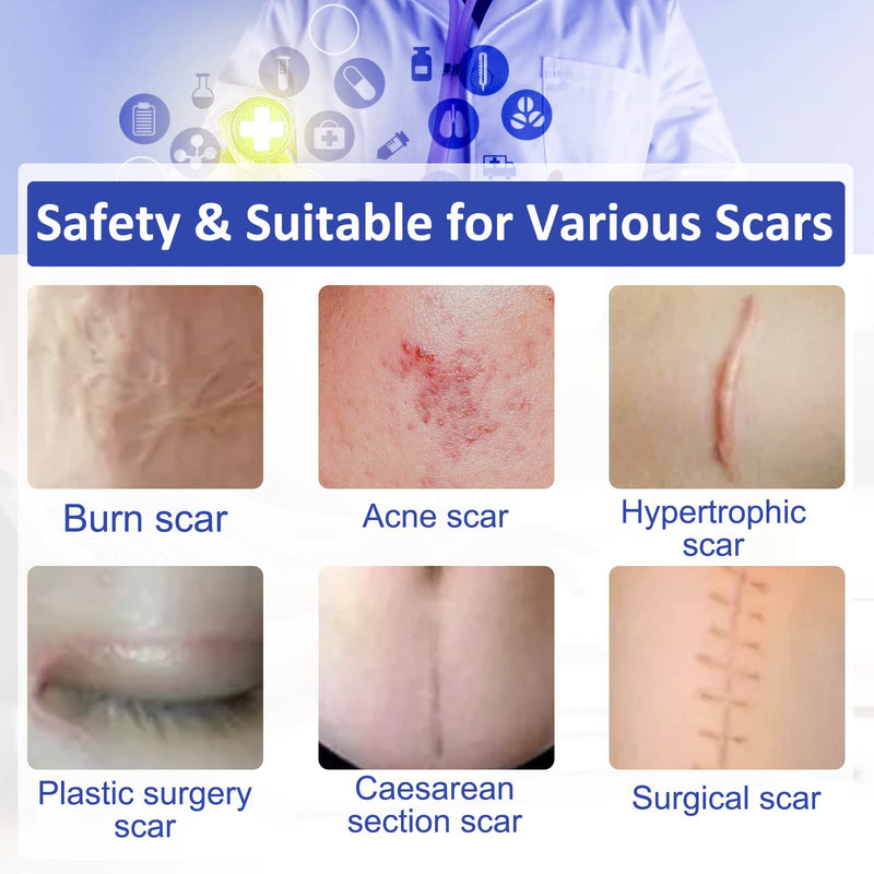 [Australia] - Advanced Silicone Scar Sheets, Transparent Strips, Gel Tape for Scar Removal, Reusable and Effective Removal New and Old Scars(4X300CM Roll) Blue 