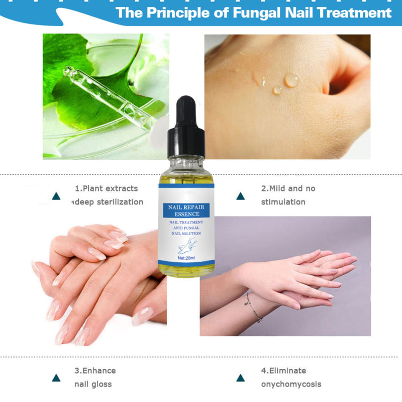 [Australia] - Nail Fungus Treatment ,Fungal Nail Treatment for Toenail,Toenail Fungus, Nail Fungus, Antifungal Toenail Treatment,Nail Repair Fungal Nail Solution 