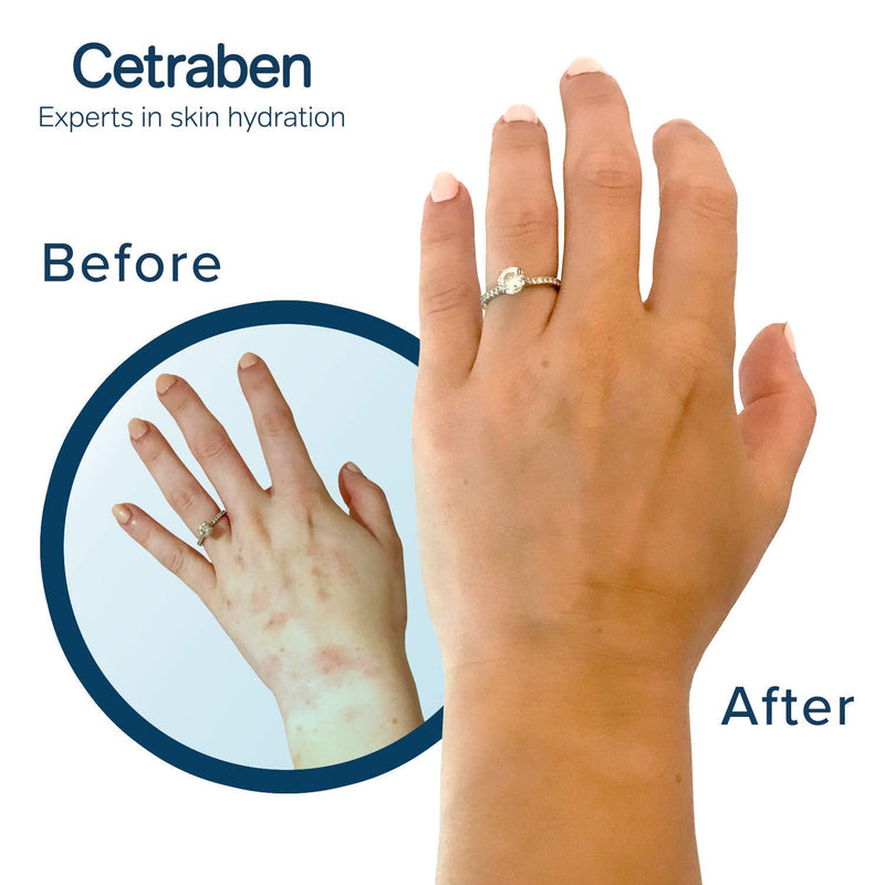 [Australia] - Cetraben Natural Oatmeal Cream, Body Cream, Dry Skin Moisturiser Suitable For Sensitive and Eczema-Prone Skin – 190g 
