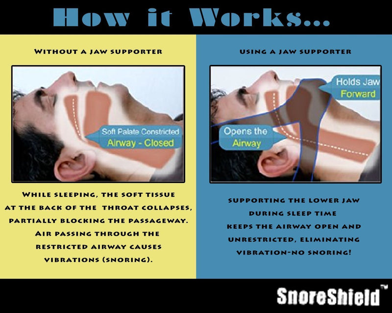 [Australia] - SnoreShield Anti Snore Chin Strap - The #1 Ranked Snoring Sleep Solution - Natural And Comfortable Instant Snore Stopper - Easy To Use And Adjustable 