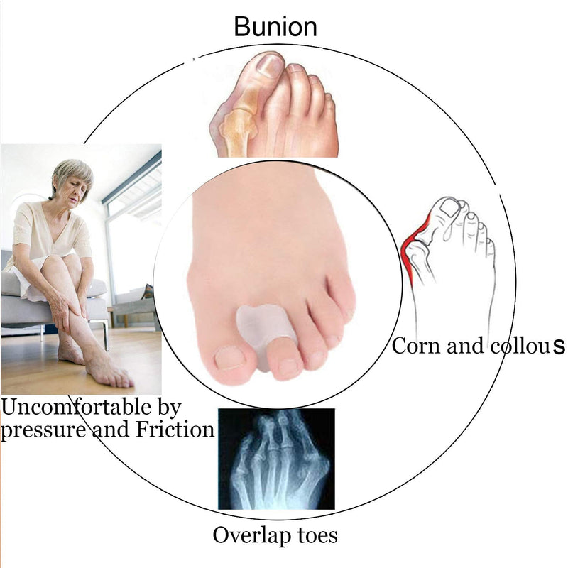 [Australia] - 10 Pieces Toe Protectors and Toe Spacers, Bunion Corrector, Big Toe Separator to Correct Big Toe Bunion, Overlapping Toes, Hammer Toes - (Clear) 
