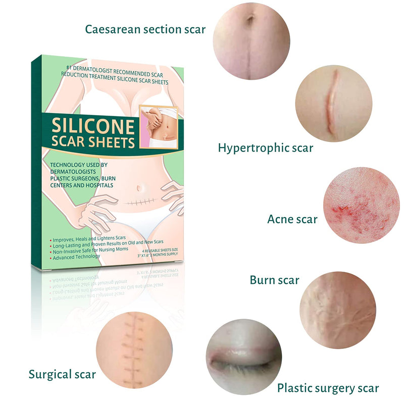 [Australia] - Silicone Scar Removal Leaves, Scar Reduction, Treat New and Old Scars, Quickly and Effectively Removes Scars for Acne Scars, Stretch Marks, Burning, Pack of 4 A 