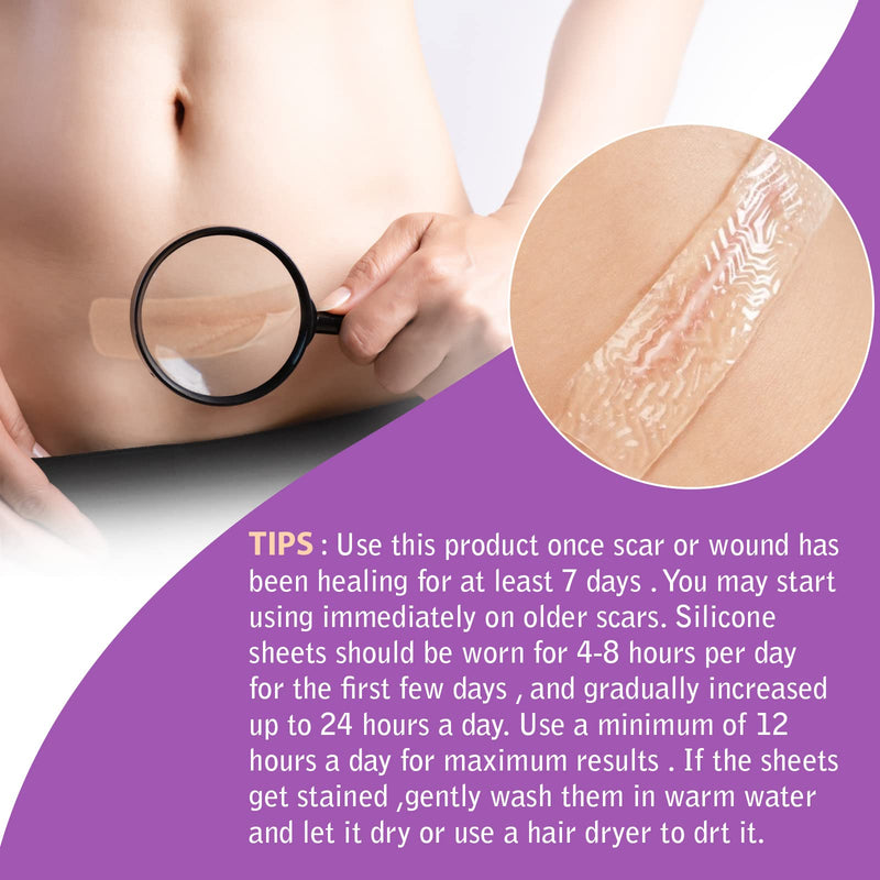 [Australia] - Silicone Scar Sheets(1.6" x 120"), Scar Tape for Scars Removal Treatment, Reusable Professional Scar Removal Strips for New and Old Scars 