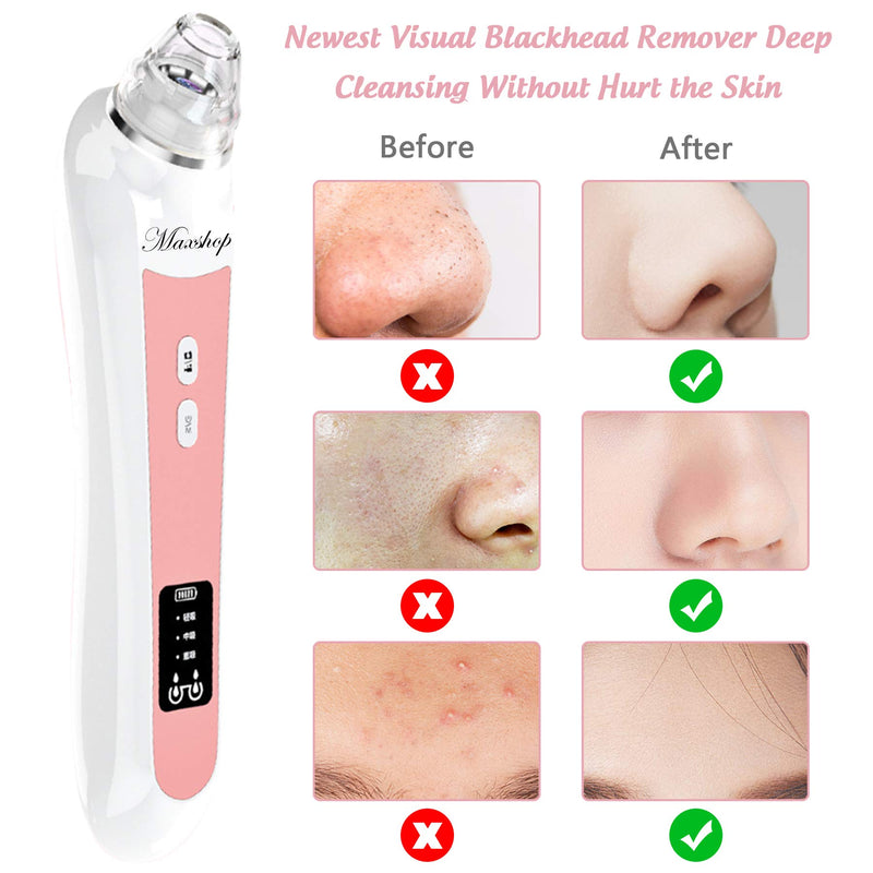 [Australia] - Blackhead Remover Pore Vacuum. MAXSHOP 5.0 Megapixels Camera Visible Facial Electric Pore Cleaner with 20x magnification, Portable Rechargeable Pore Cleanser, Compatible with Phone/Tablet/PC 