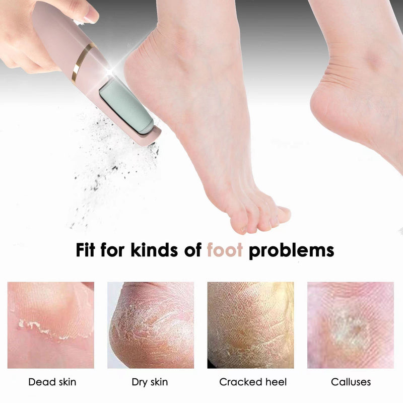 [Australia] - Foot File,Dongxw Electric Foot Callus Remover USB Rechargeable Waterproof Hard Skin Remover Foot with 2 Rollers LED Light,8 in 1 Foot Scraper Foot Care Gift Kit for Cracked Heels Calluses Dead Skin 