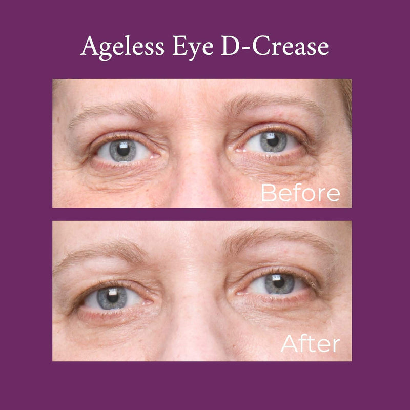 [Australia] - PRAI Beauty Ageless Eye D-Crease - Anti-Aging & Anti-Wrinkle Eye Creme - 0.5oz 