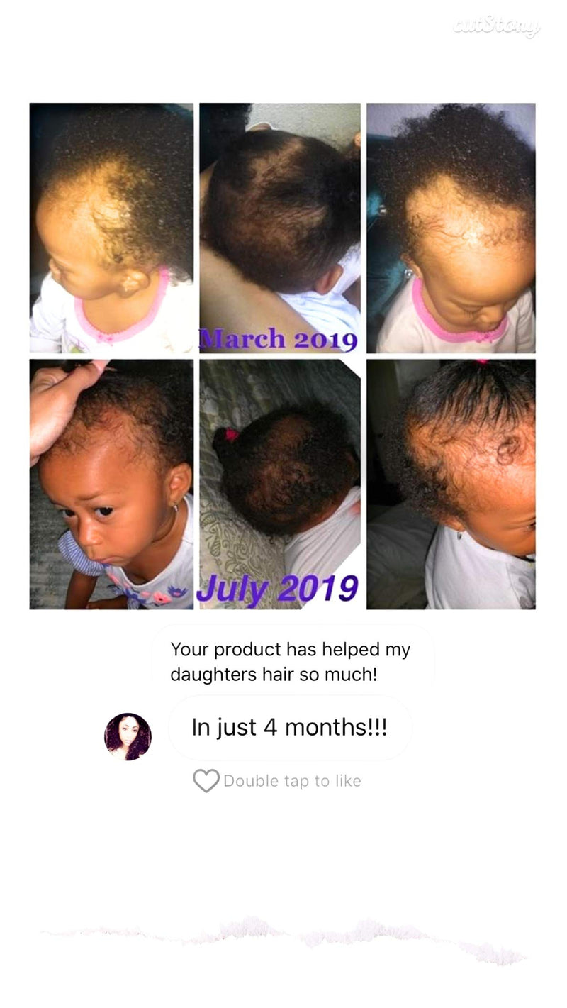 [Australia] - J‚ÄôOrganic Solutions Biotin hair growth Stimulating Conditioner (for kids) with Argan Oil, Aloa Vera & more 